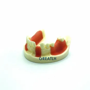 Zobni Spodnja Čeljust Gingiva Vsadek Praksi modela manjkajočih zob zobozdravnik izobraževalne študent študija zob opravljati model